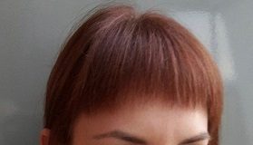 zocca