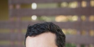 “Daratumumab monotherapy for refractory lupus nephritis” pubblicato su Nature Medicine